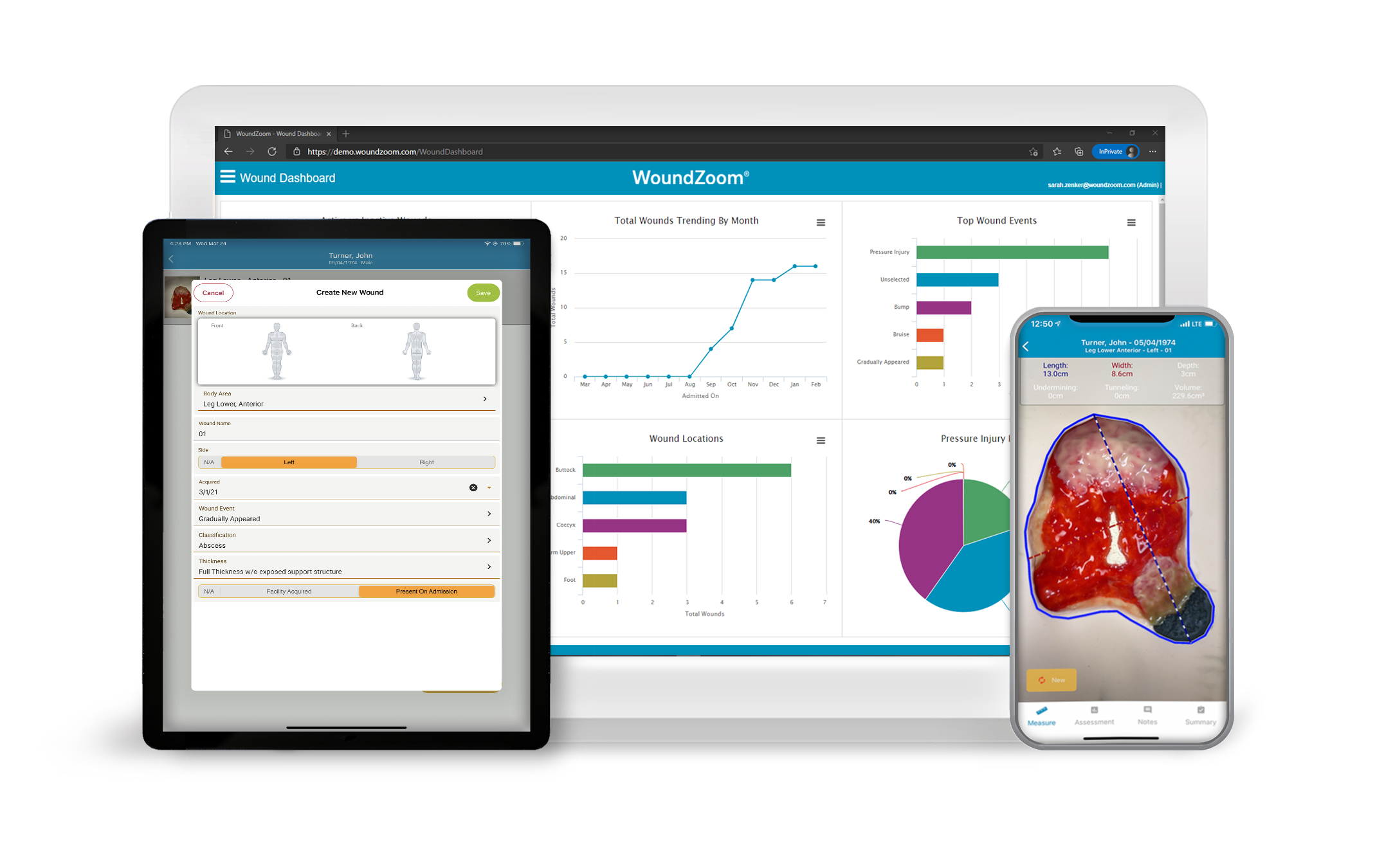WoundZoom Digital Wound Management Perceptive Solutions
